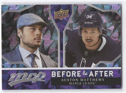 2021-22 Upper Deck Mvp Hockey Before & After Ba-1 Auston Matthews